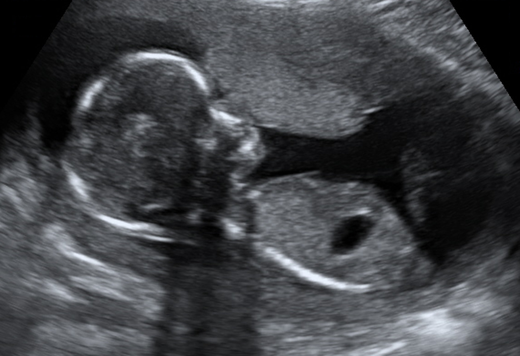 An ultrasound image showing our baby.